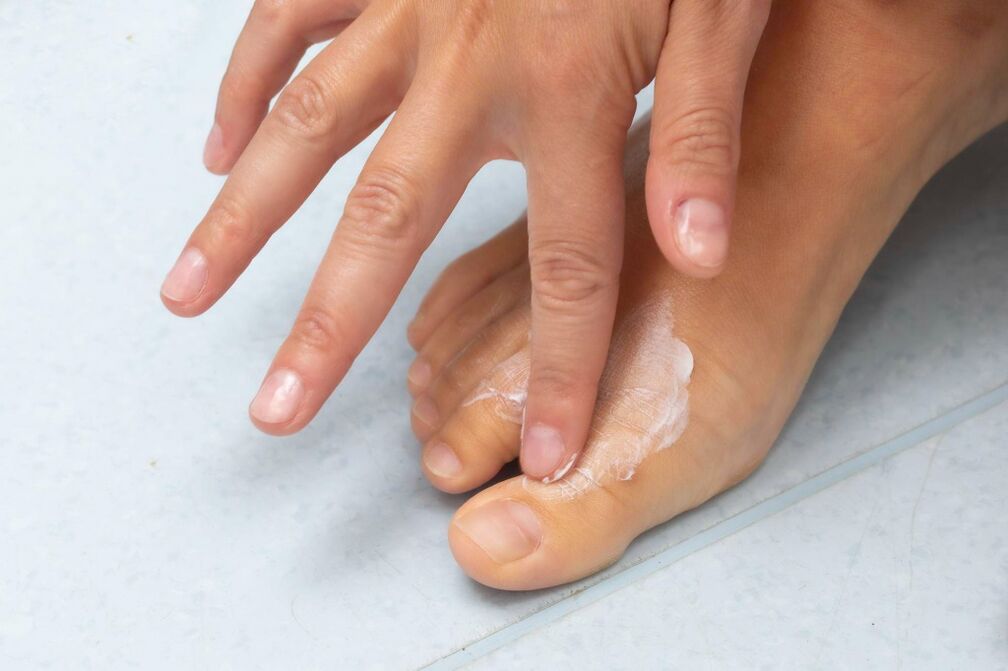 Demyxil Crème Application du fungo entre les doigts des Feets